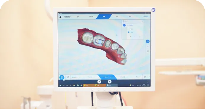 歯を早く修復したいあなたへ