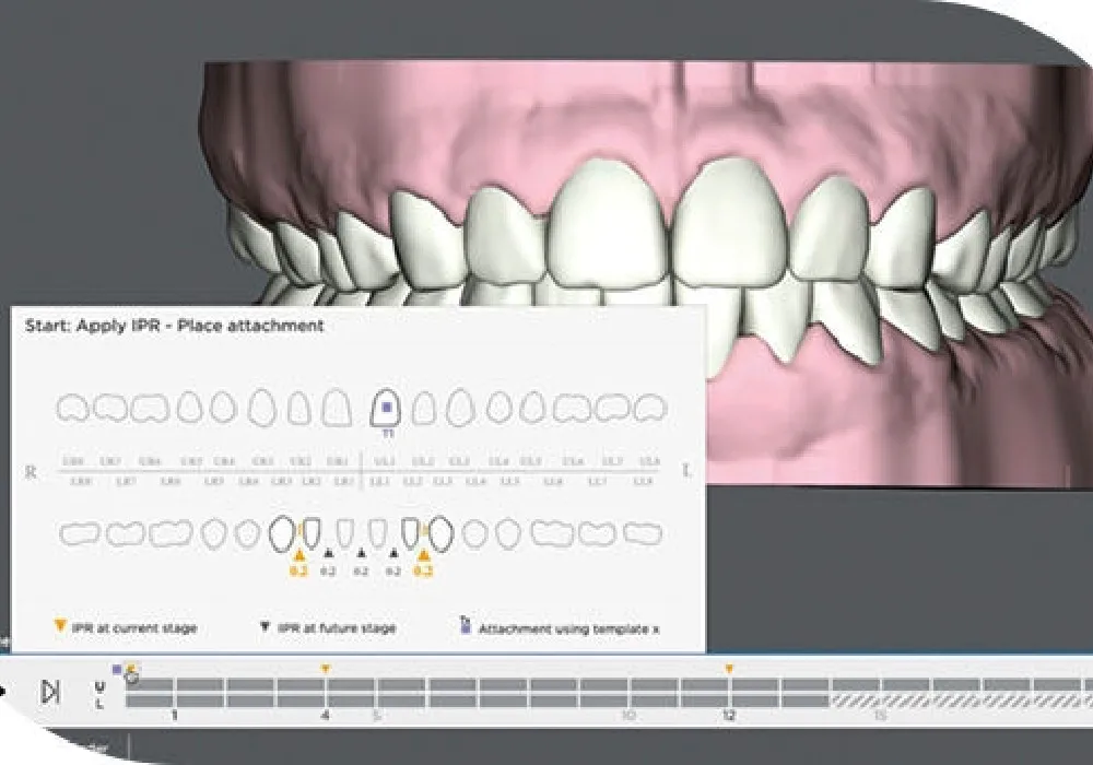 自費治療ながらリーズナブル|大和市大和駅徒歩4分の歯医者 大和東さくら歯科・矯正歯科