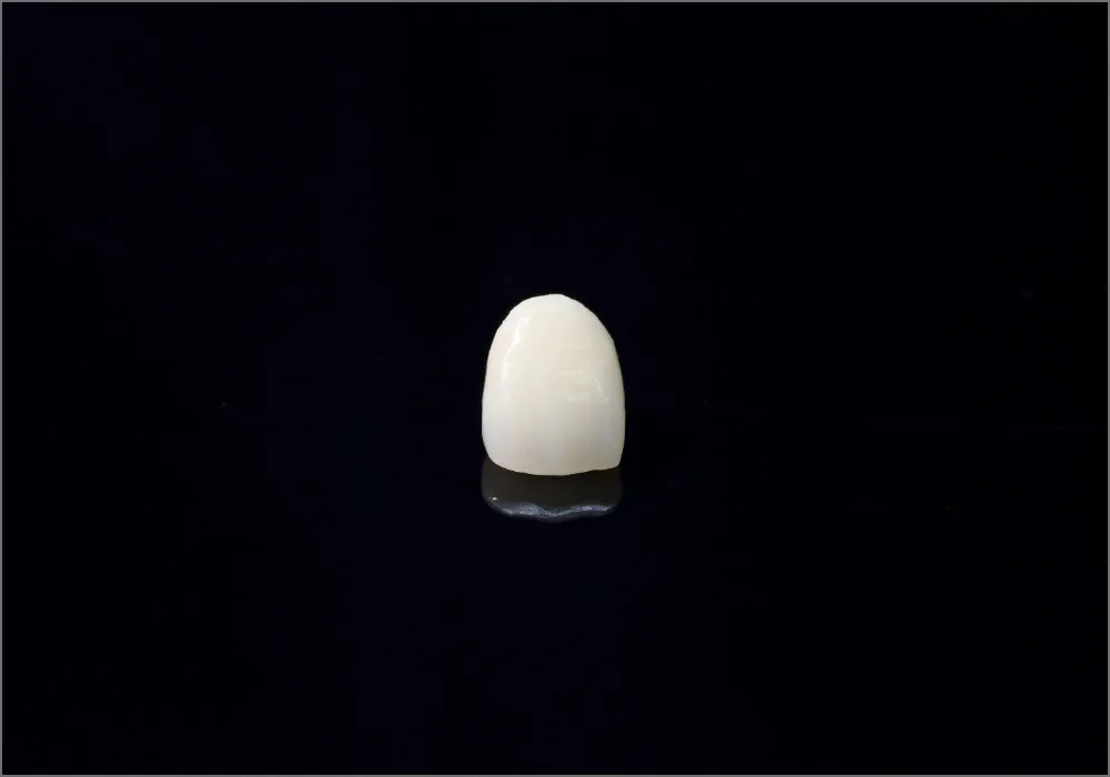 セラミッククラウン|大和市大和駅徒歩4分の歯医者 大和東さくら歯科・矯正歯科