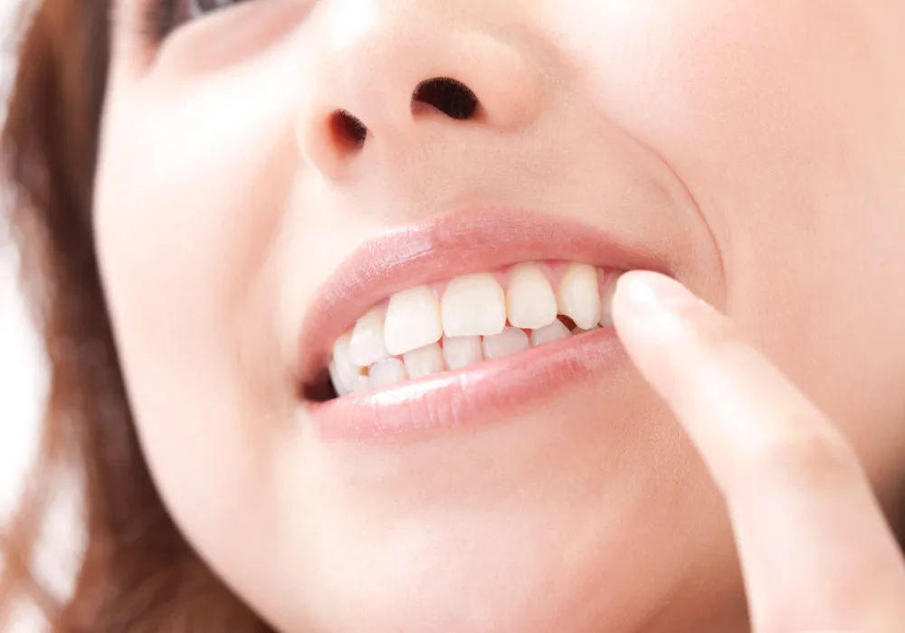 オフィスホワイトニング|大和市大和駅徒歩4分の歯医者 大和東さくら歯科・矯正歯科