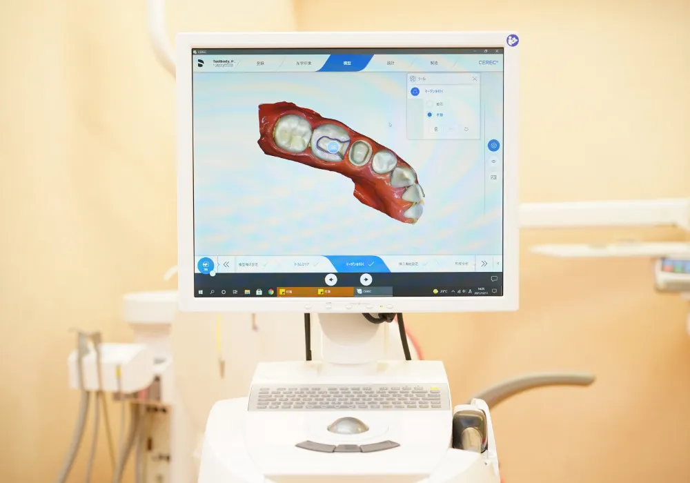 セレックシステム|大和市大和駅徒歩4分の歯医者 大和東さくら歯科・矯正歯科