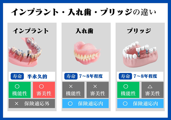 インプラント・入れ歯・ブリッジの違い