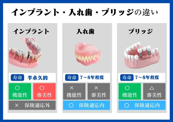 インプラント・入れ歯・ブリッジの違い