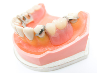 多種多様な入れ歯